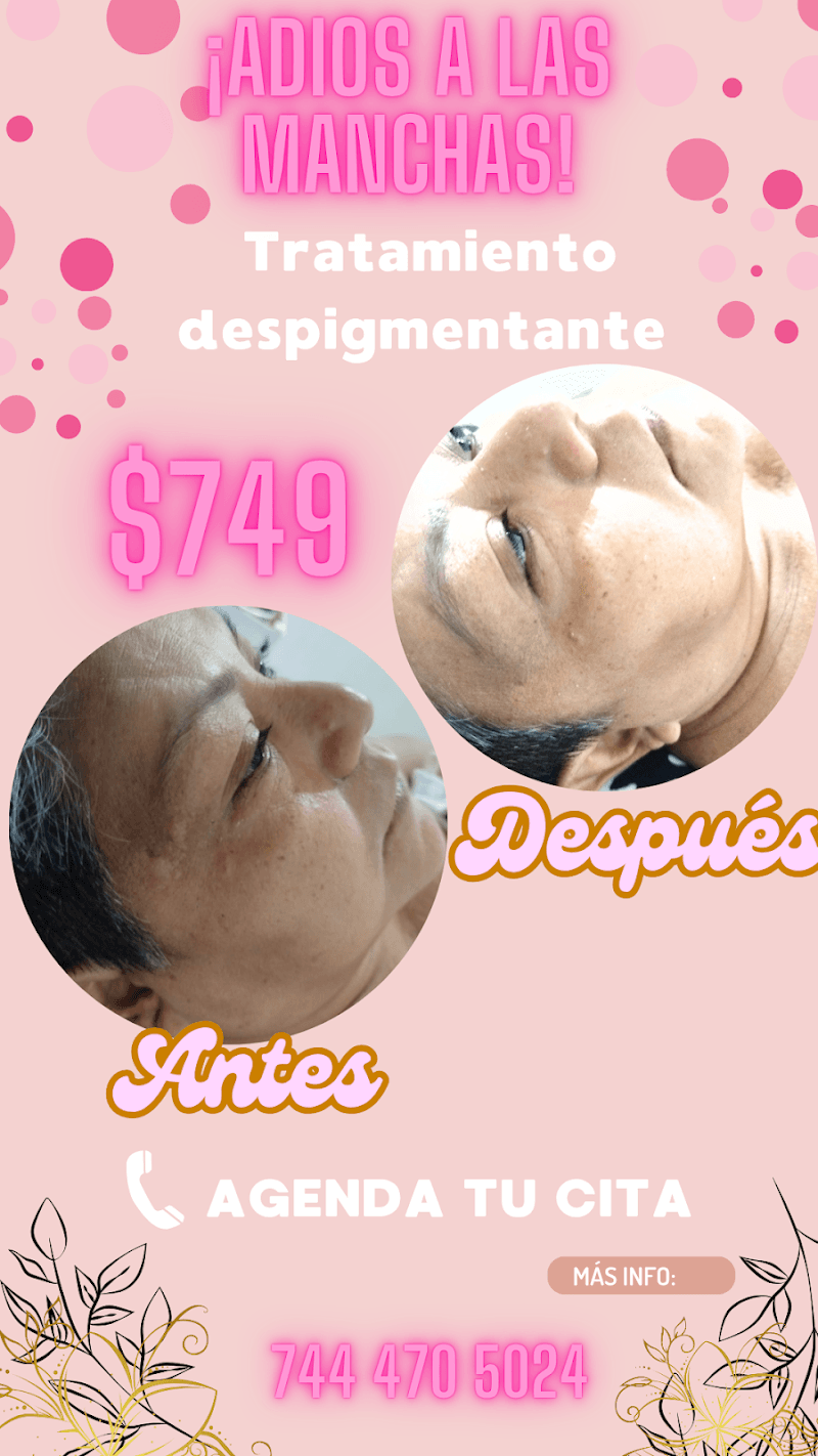 Beauty Clinic cosmetología Acapulco de Juárez photo