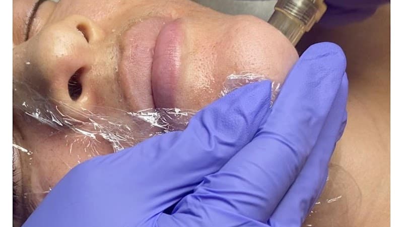 Beauty DuJour Aesthetics Dallas photo