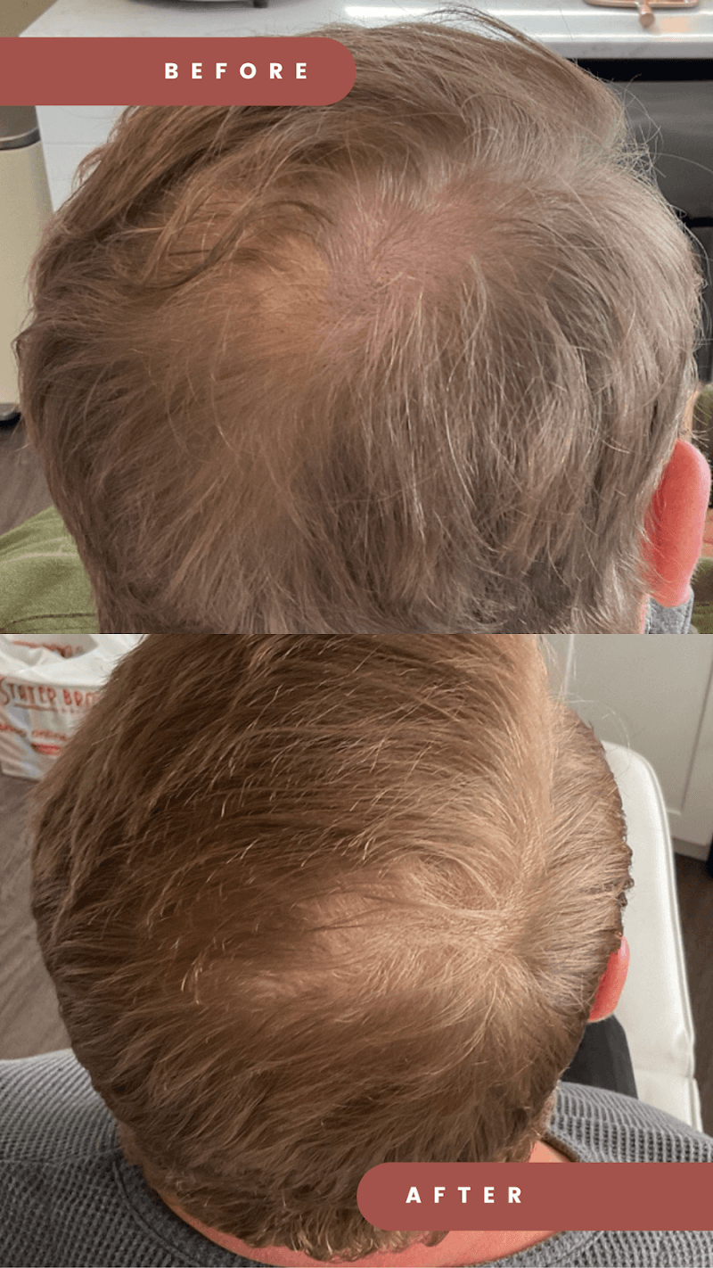 Beauty Enhanced Aesthetics Redlands photo