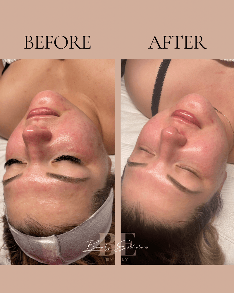 Beauty Esthetics by Ally Victorville photo