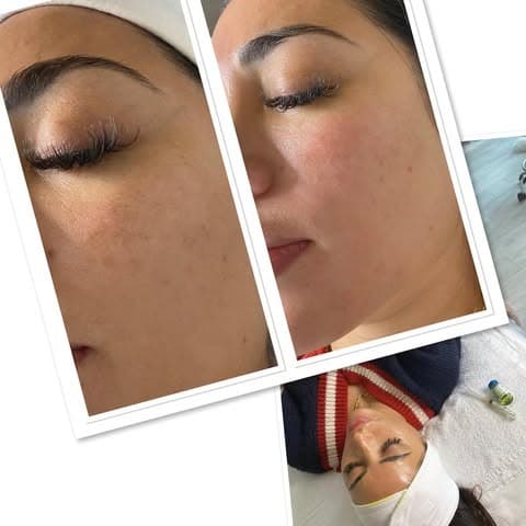 Beauty in Rosedale Toronto photo