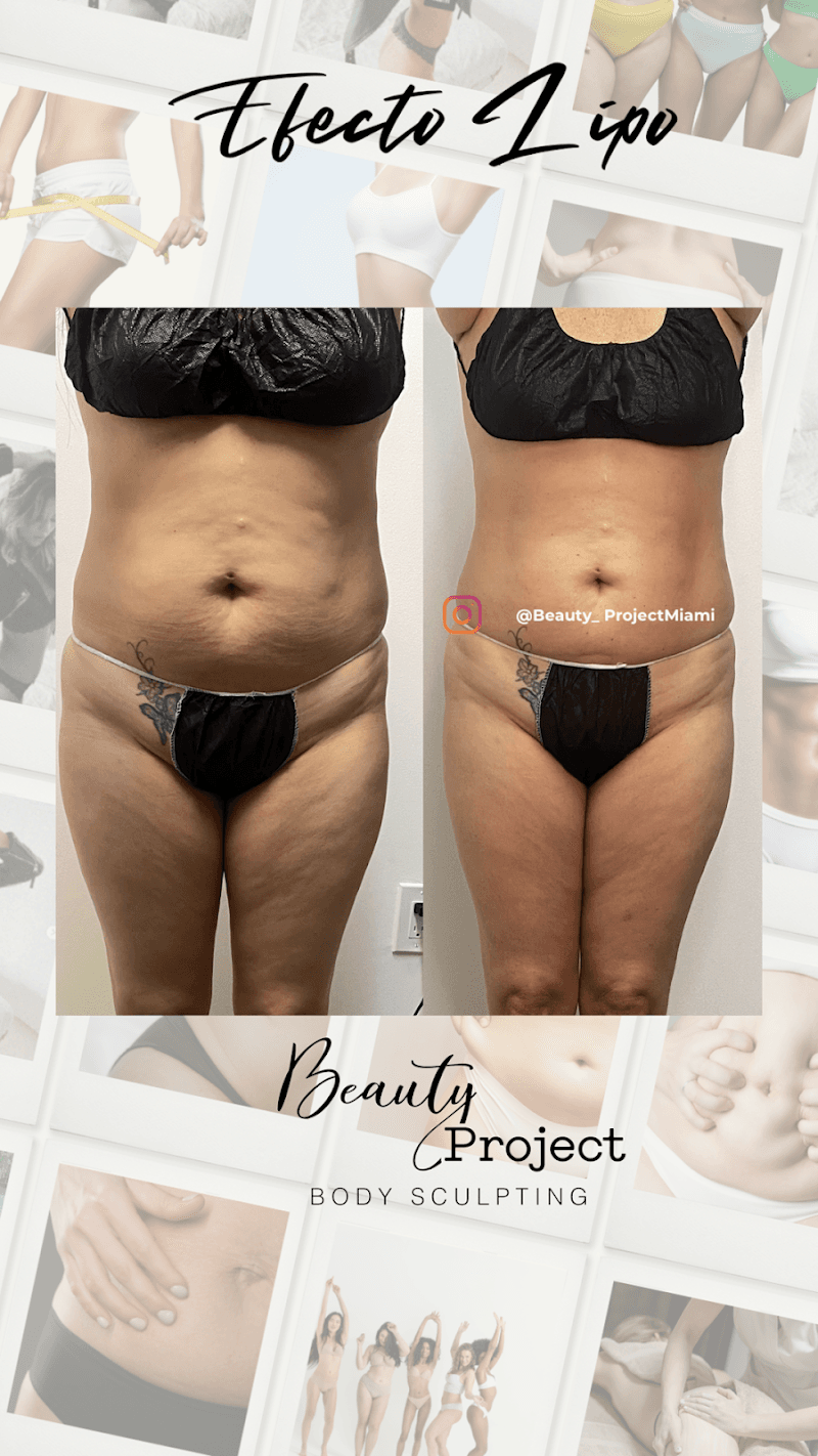 Beauty Project Brickell Miami photo