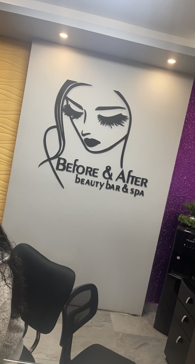 Before & After Reynosa photo