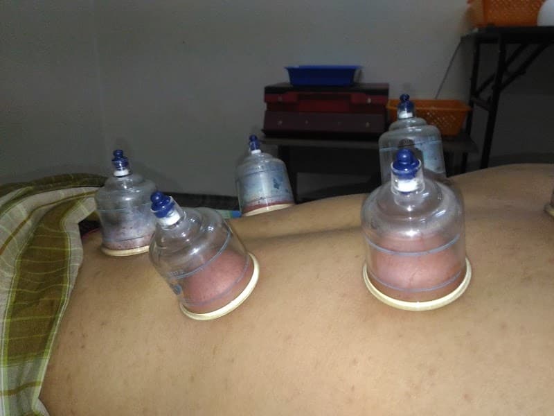 Bekam Sunnah Baginda Kuantan photo