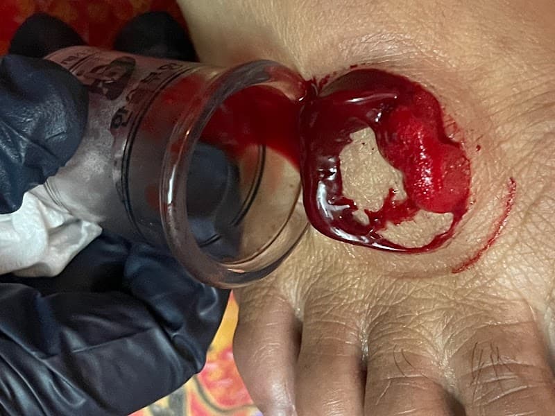 Bekam Sunnah Wanita Kajang photo