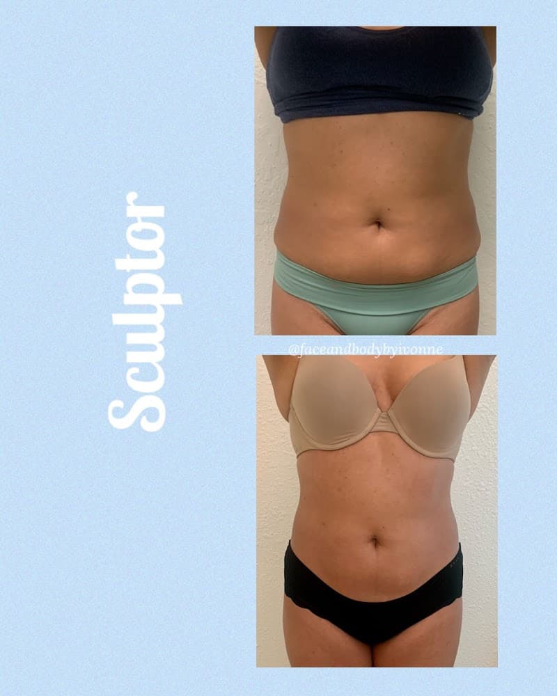 Bella Estetica Spa and Body Chandler photo