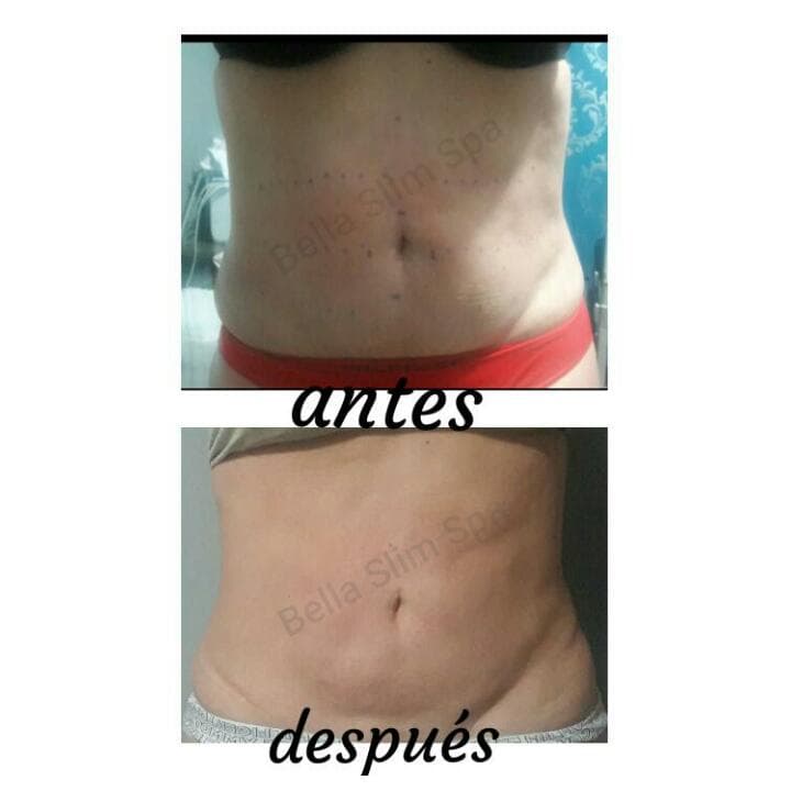 Bella Slim Spa Mexicali photo