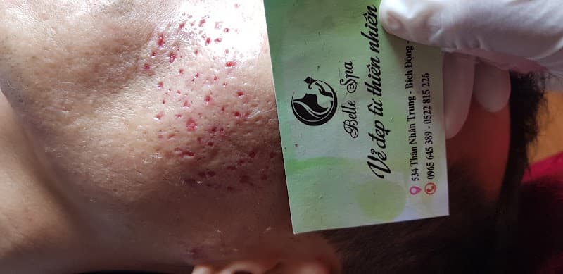 BelleSpa Huyện Việt Yên photo
