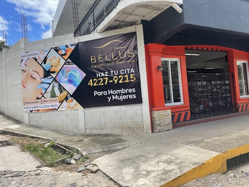 Bellus Gualan Gualán photo