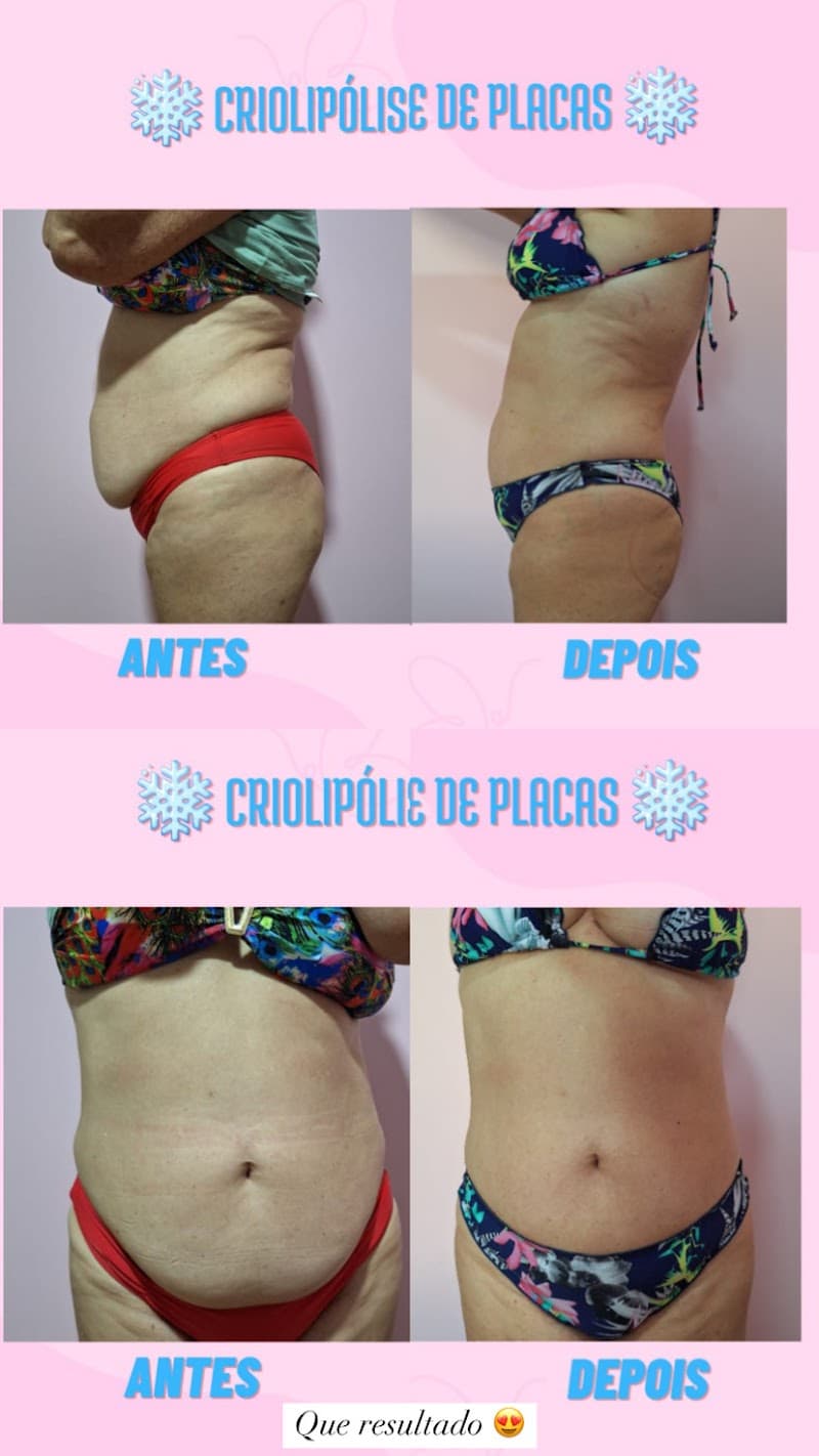 Bem Bella | Beauty Clínic Perdões photo