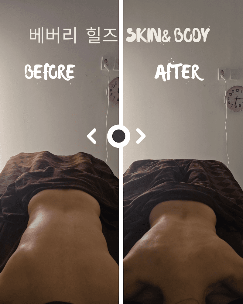 Beverly Hills Skin & Body Daegu photo