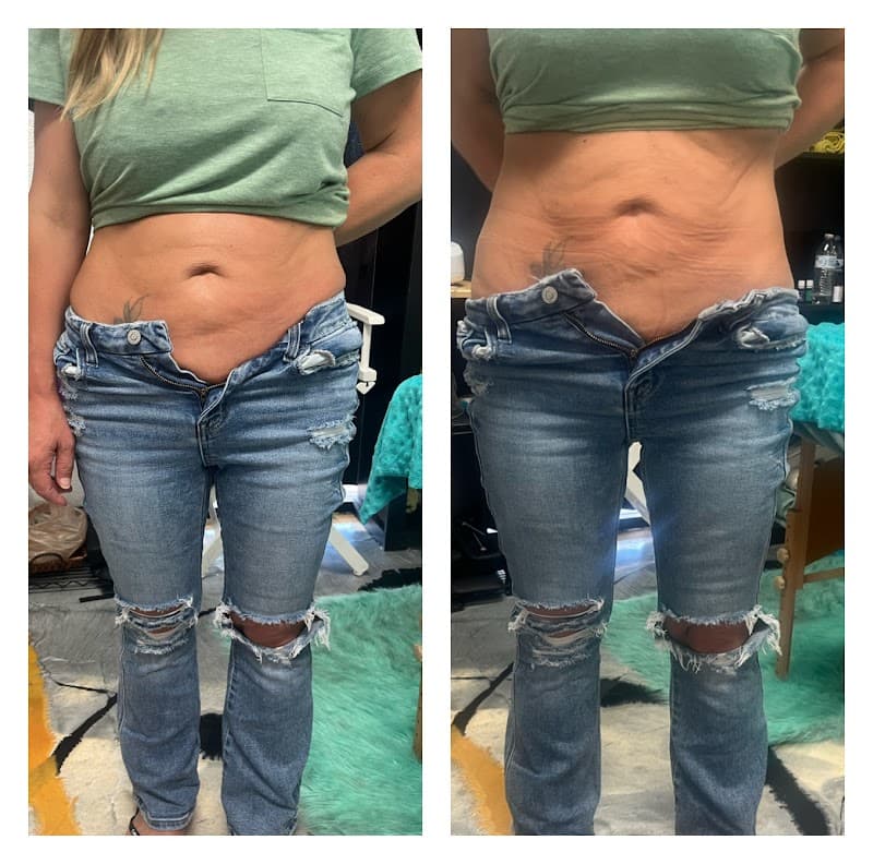 Beyond Face and Body Spa Peoria photo
