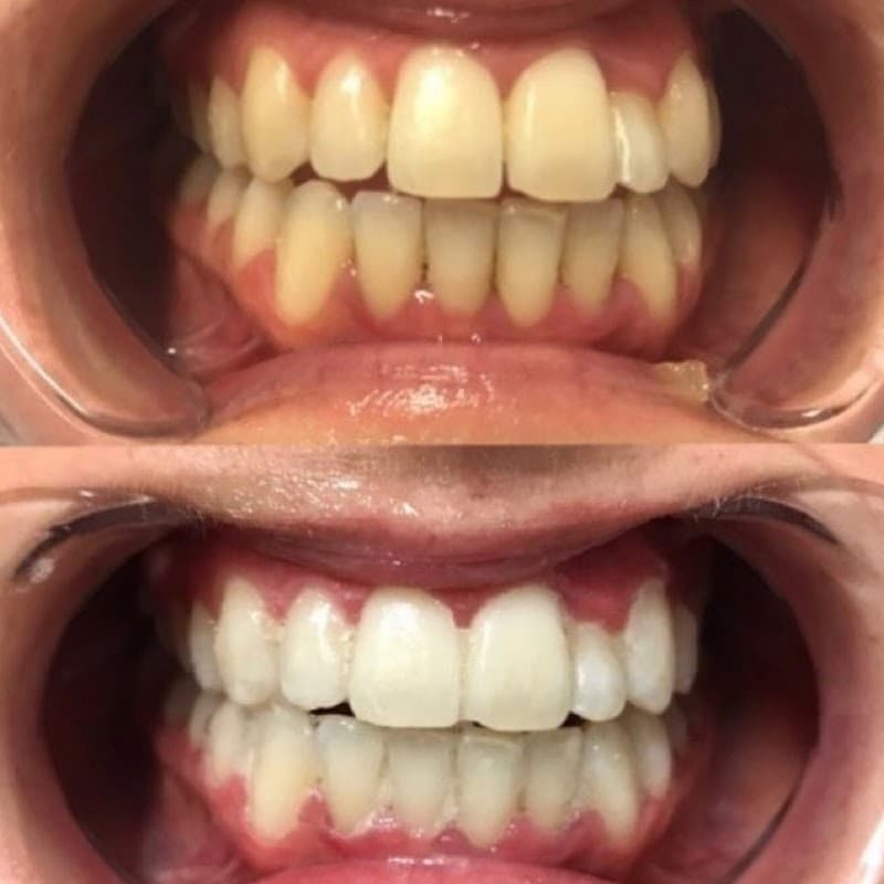 Beyond Skin - Beauty Therapy & Day Spa Gold Coast photo