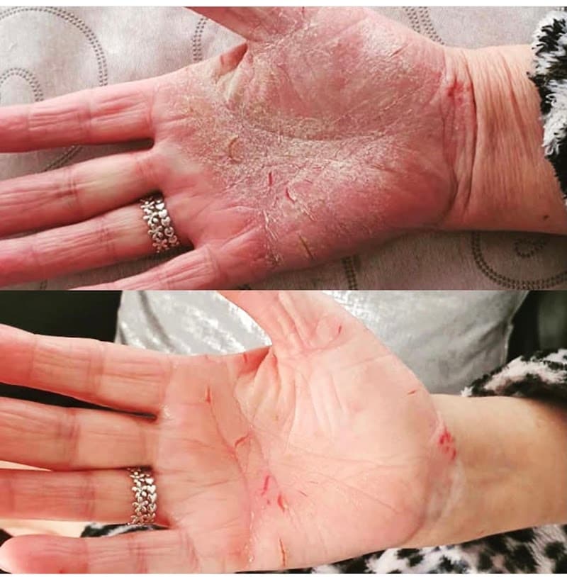 Blessing Natural Therapies Liverpool photo