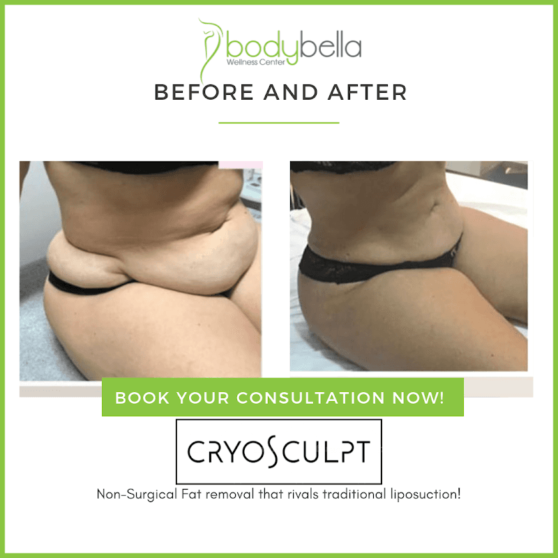 Body Bella Wellness Center Dunwoody photo