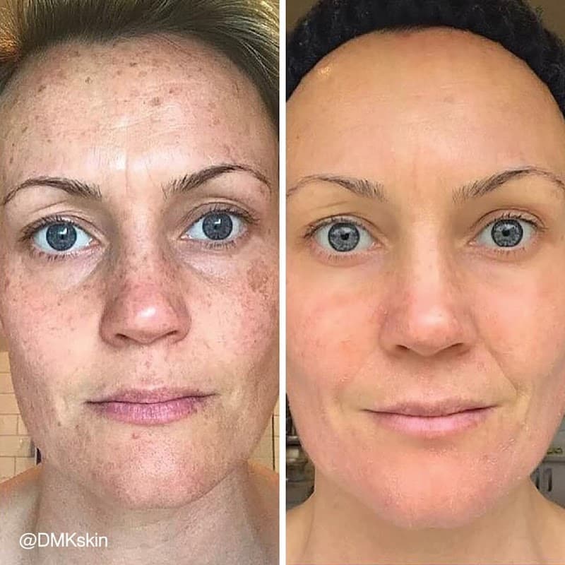 Body Bliss Medi Spa and Skin Clinic Brisbane photo