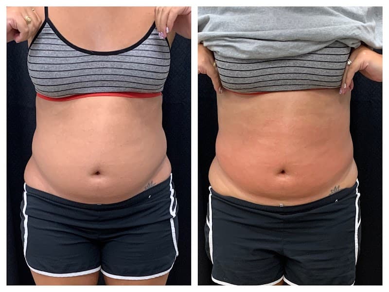 Body by Barb College Station photo
