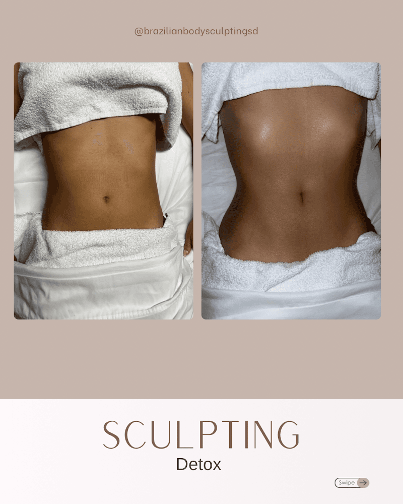 Body Sculpting and Massage by Daniel Lemon Grove photo
