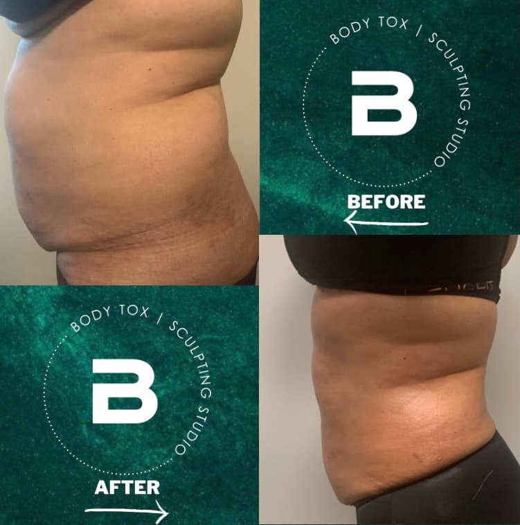 BodyTox Sculpting Studio Milledgeville photo