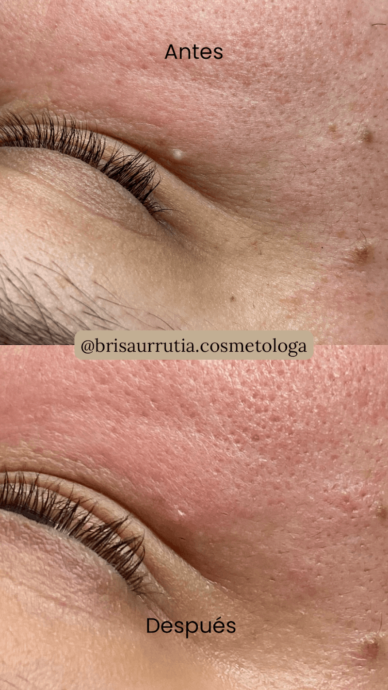 Brisa Urrutia Clínica Spa Gómez Palacio photo