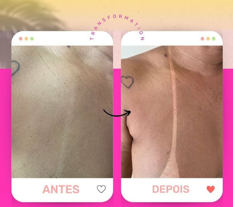 Bronze Alto Bronze Goiânia photo