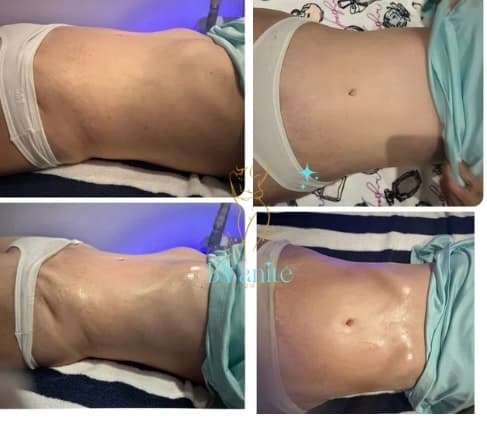 BVanitè Clinique Spa Nuevo Laredo photo