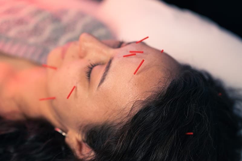 Calm Spirit Acupuncture and Massage Therapy Ukiah photo