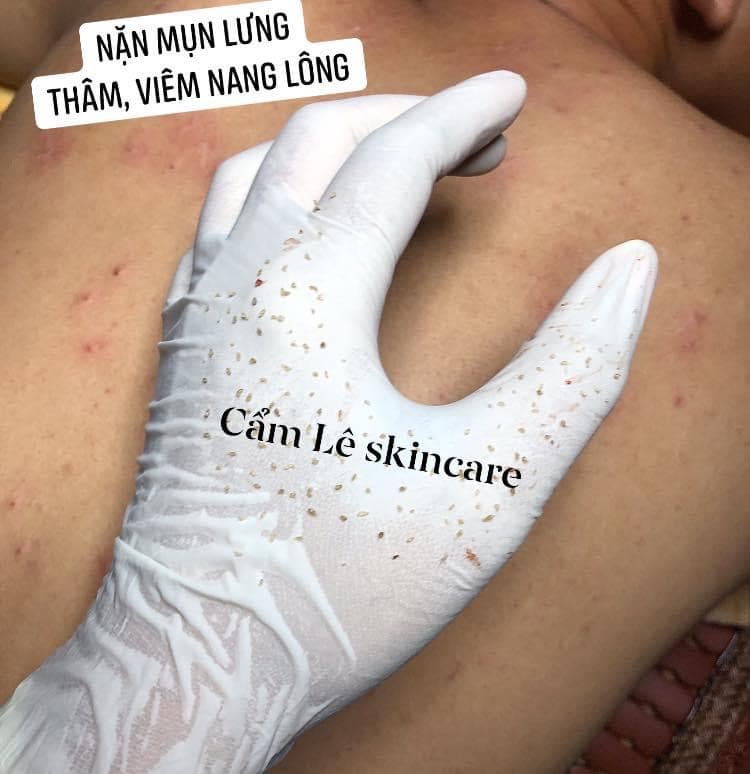 Cam Le Skincare Tây Ninh photo