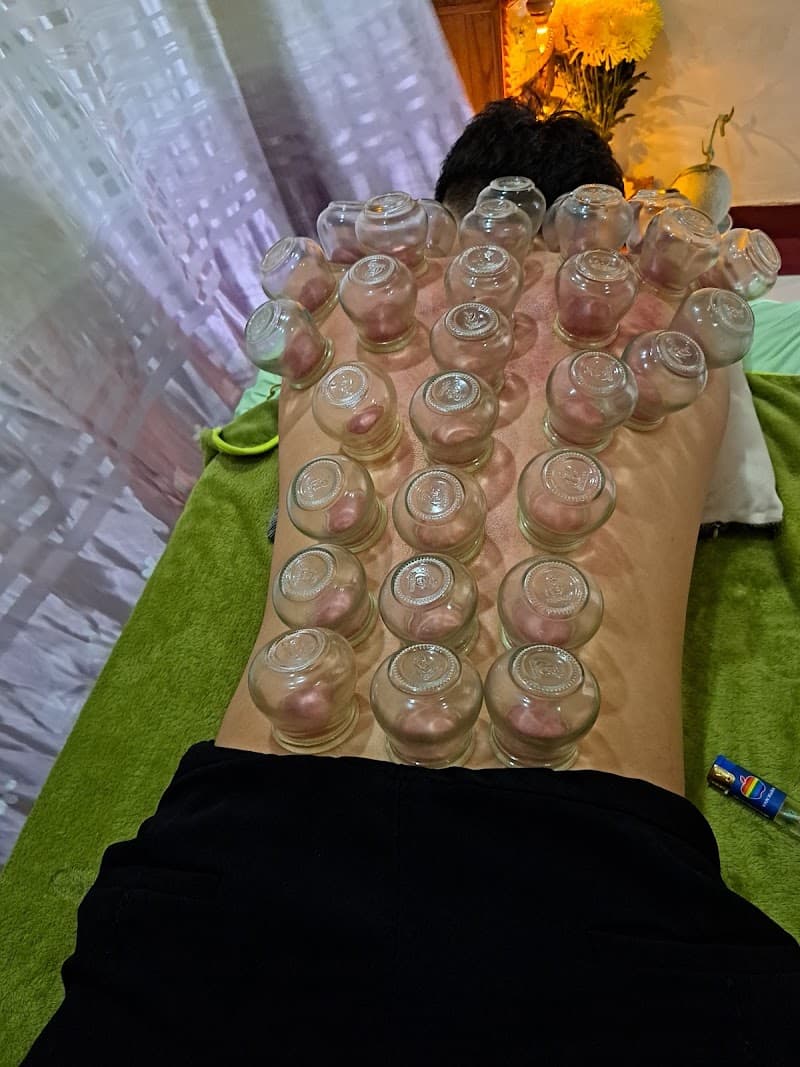 Cạo Gió Giác Hơi Quận Bình Thạnh photo