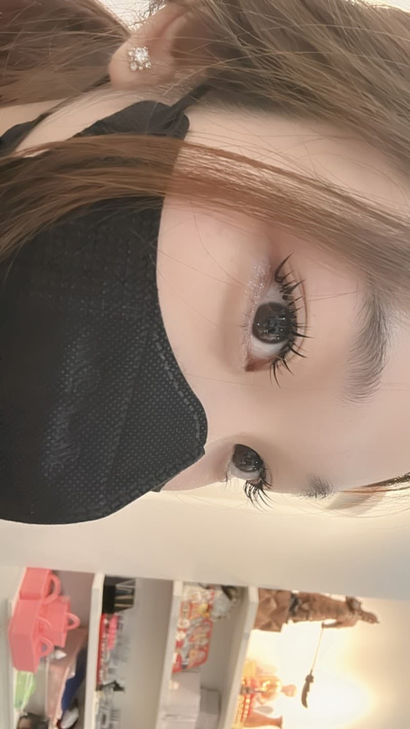 Cắt mí - Nhấn mí Đà Nẵng Quận Thanh Khê photo