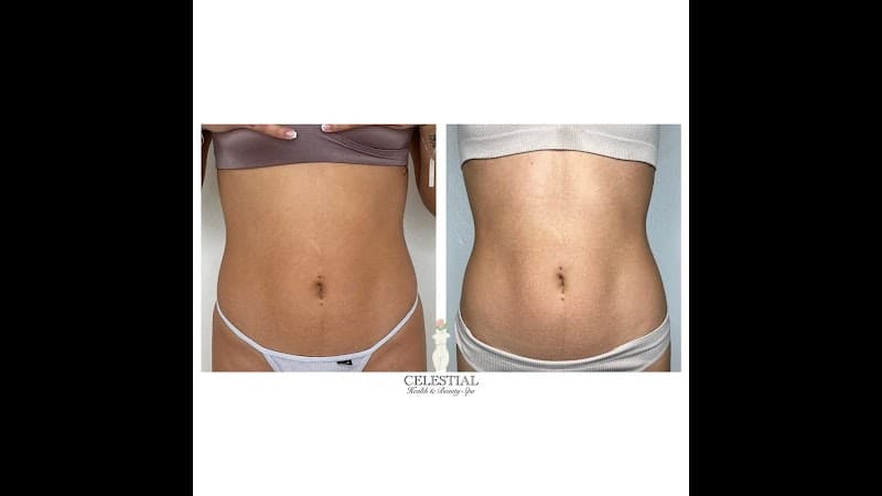 Celestial Health and Beauty Spa Woodbridge photo