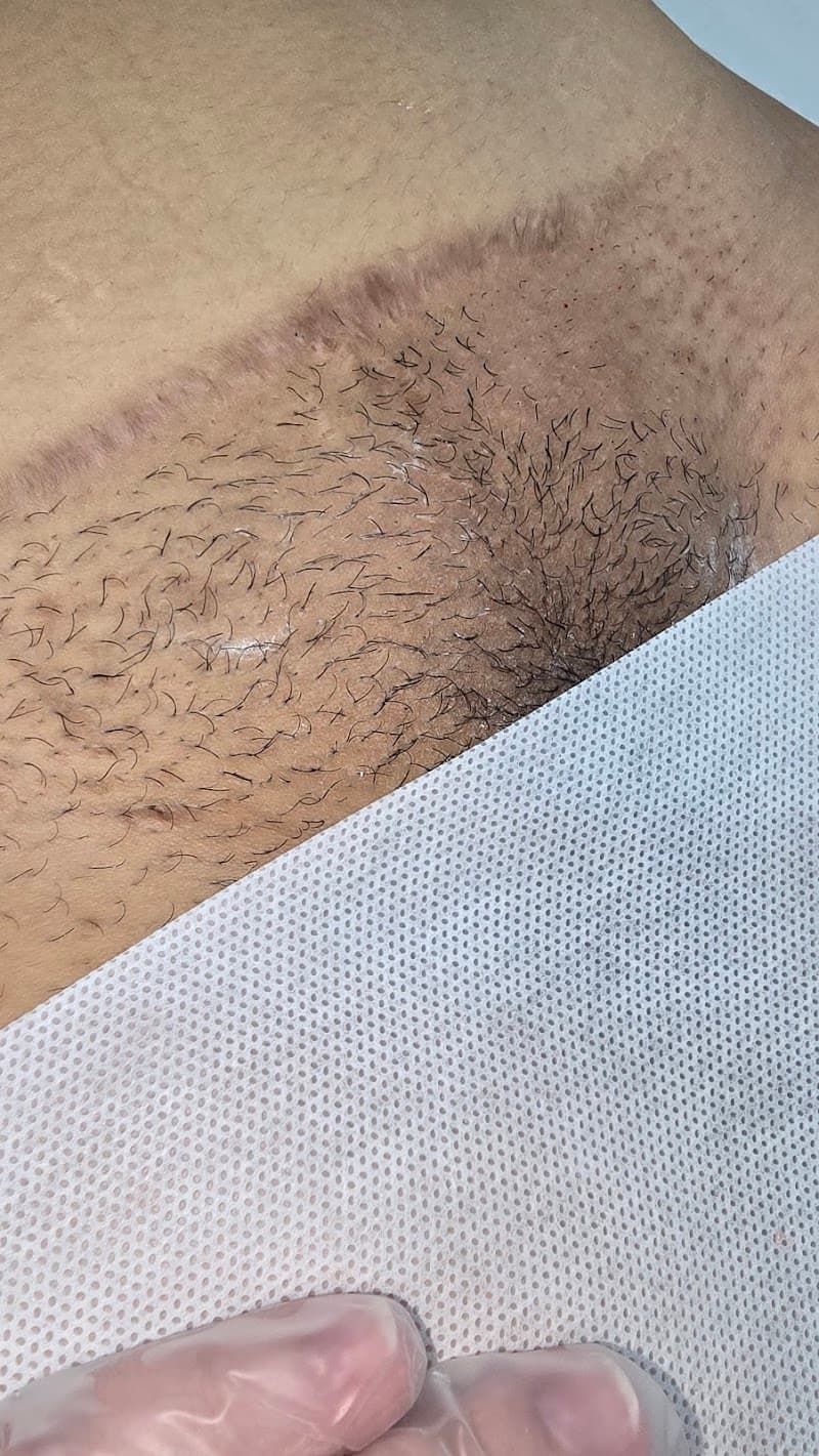 Centro de Depilação Marroquina - Camila Secaf Ribeirão Preto photo