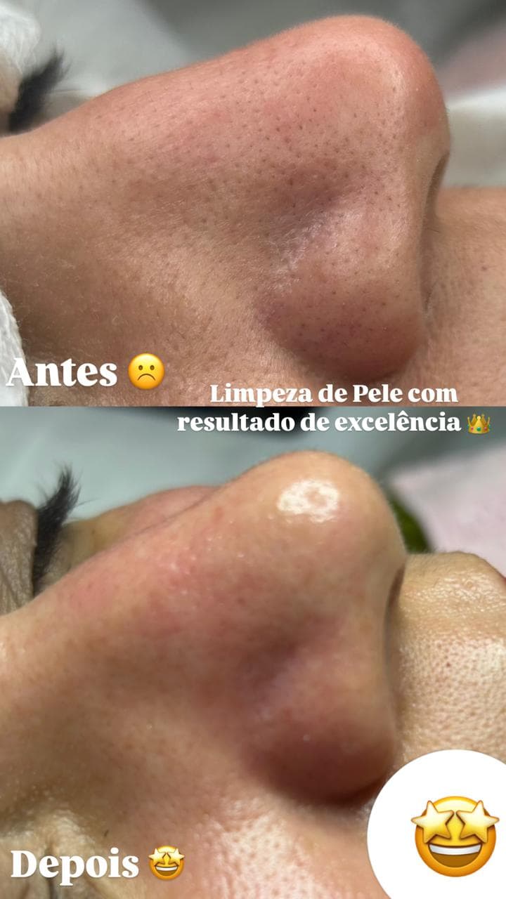 Centro de Estética Elane Resplandes Palmas photo