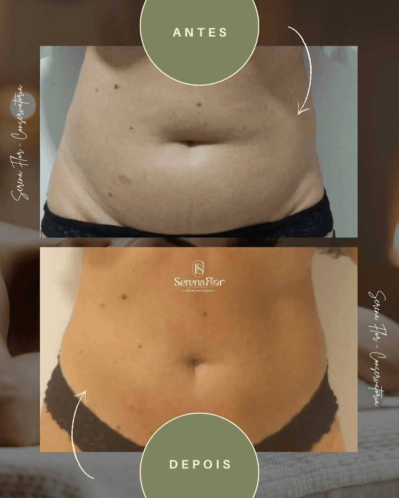 Centro de Estética Serena Flor Rio de Janeiro photo