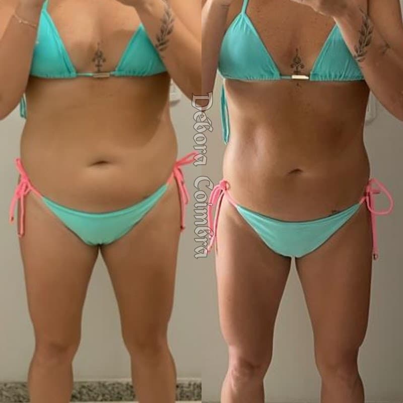 Centro Estético Débora Coimbra Nova Venécia photo