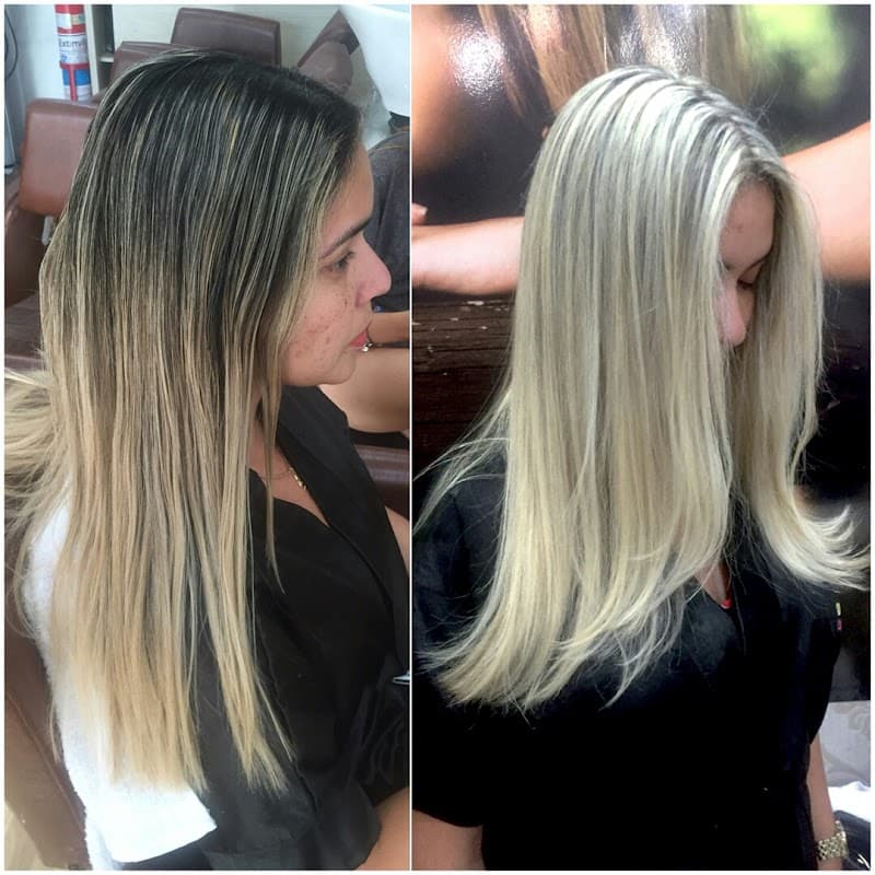 Centro Estético Super Bonita Vila Velha photo