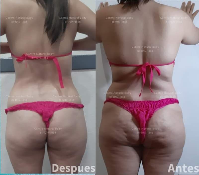 Centro Natural Body Apodaca photo