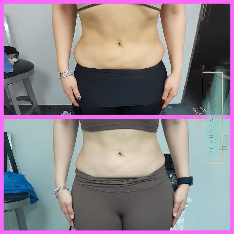 CG Cosmetology & Spa Tijuana photo