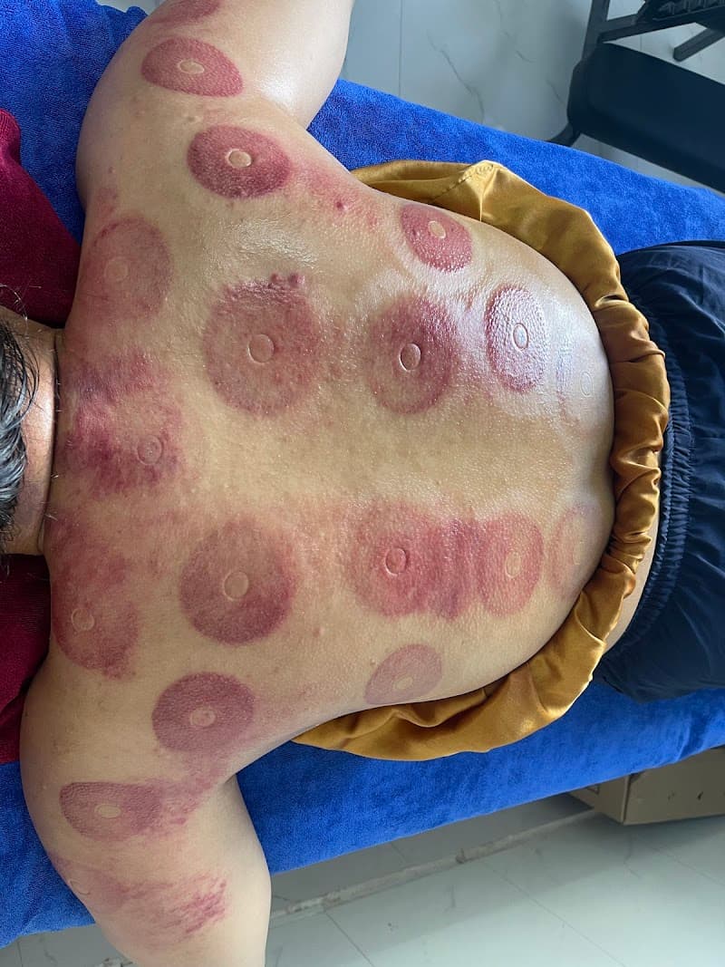 Chăm sóc vai cổ gáy - ÁNH NGUYỆT Quận Sơn Trà photo