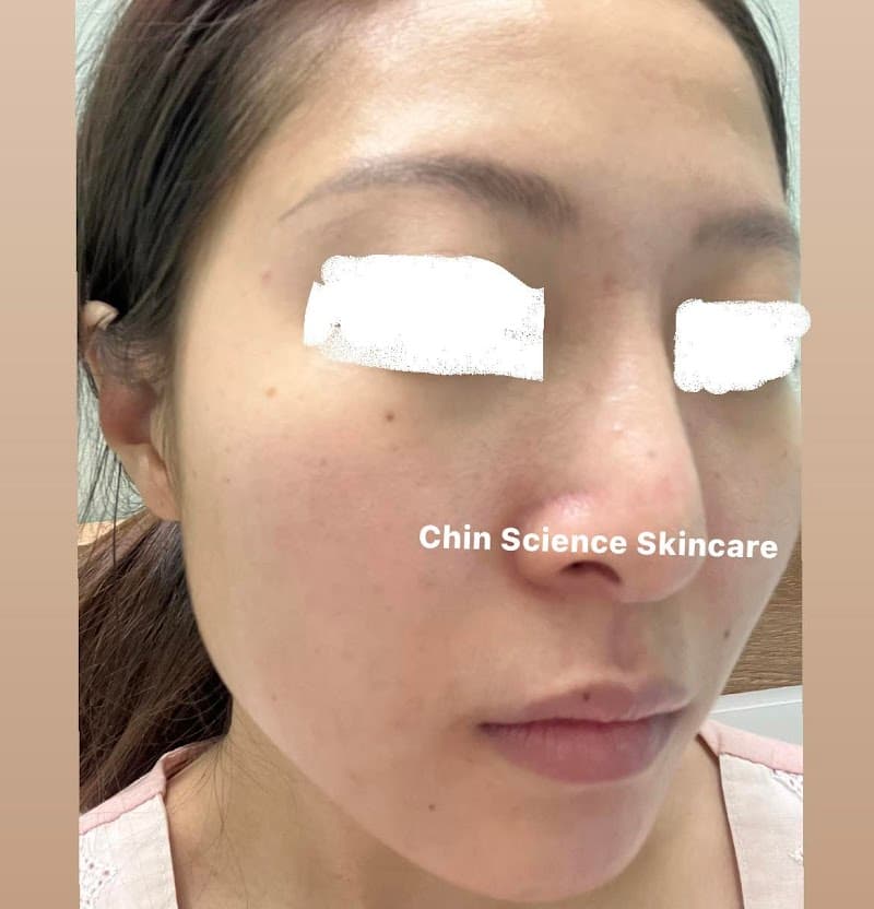Chin Science Skincare Beauty Quận Gò Vấp photo