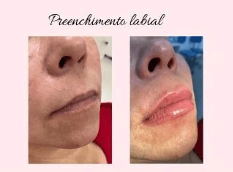 Chirlei Limas Estética Avançada Joinville photo