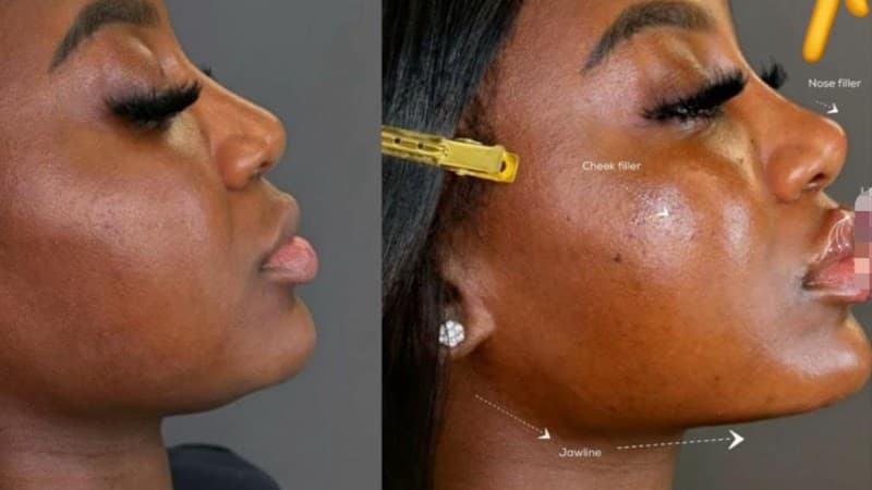 Cityb Aesthetic clinic Port Harcourt photo