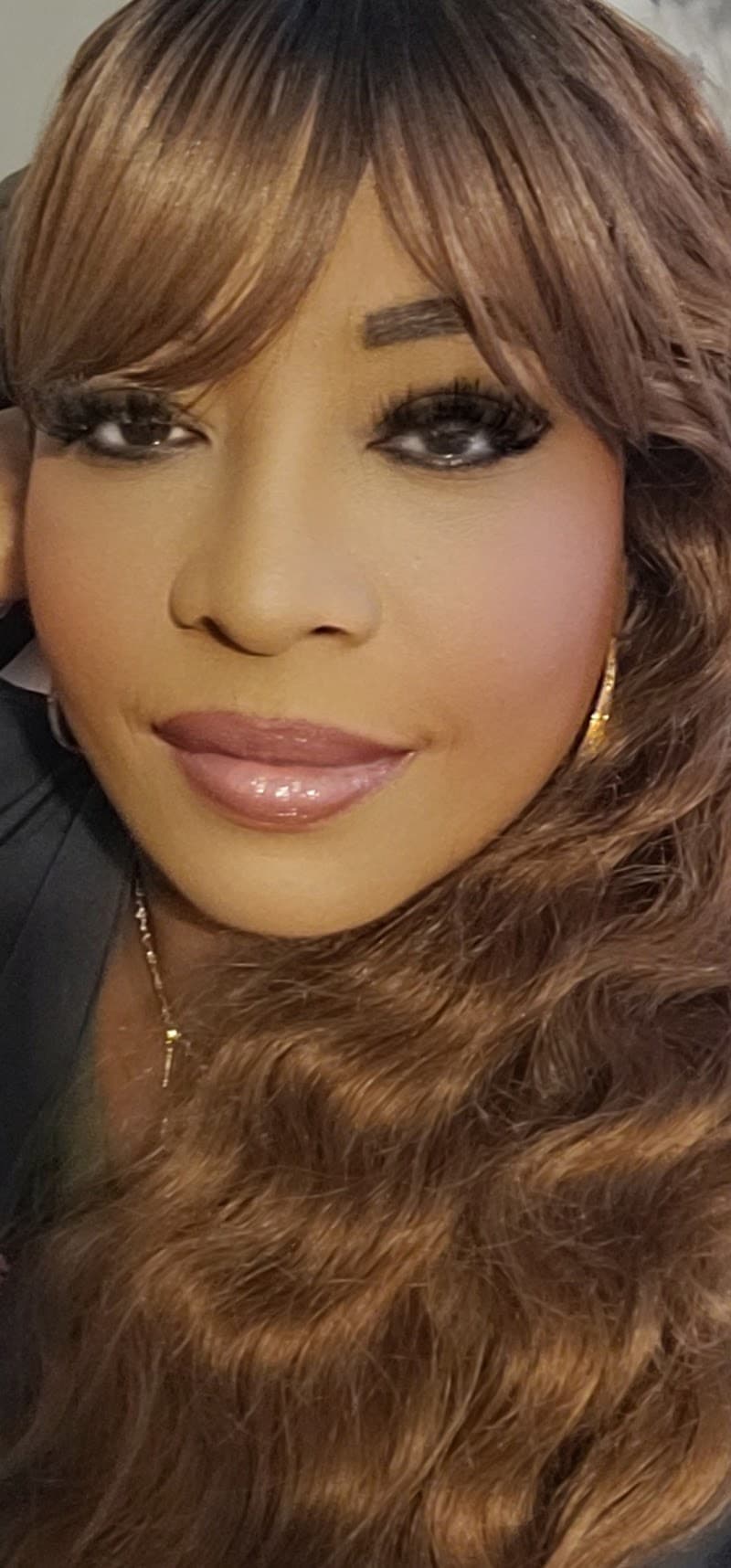 Class Skin Wellness Center Union City photo