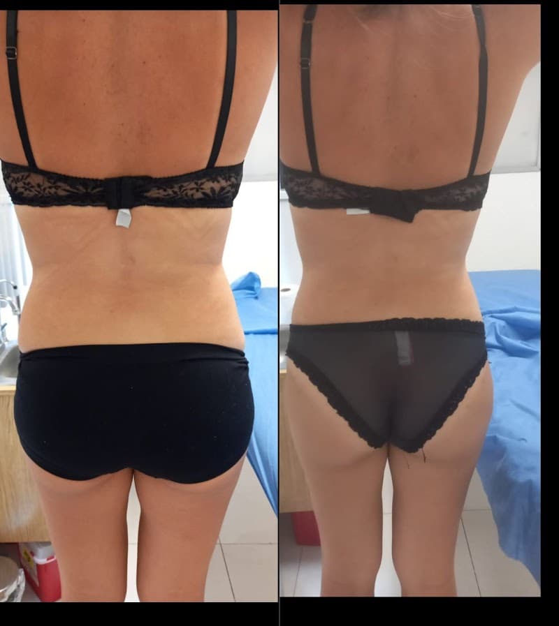 Clínica de belleza sin cirugía m'SPA Miguel Hidalgo photo