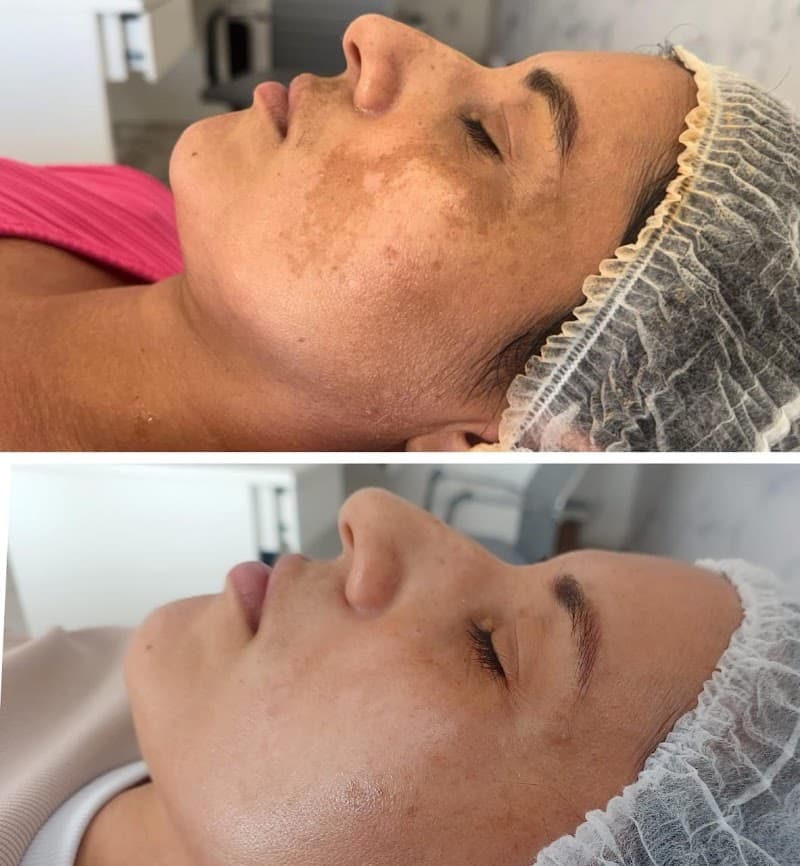 Clinica de estética slim Capelinha photo