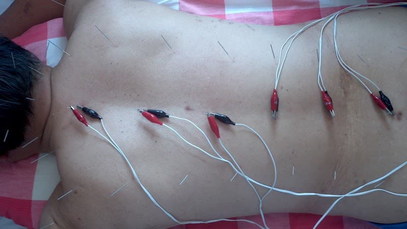 Clínica Médica de Acupuntura Zapopan photo