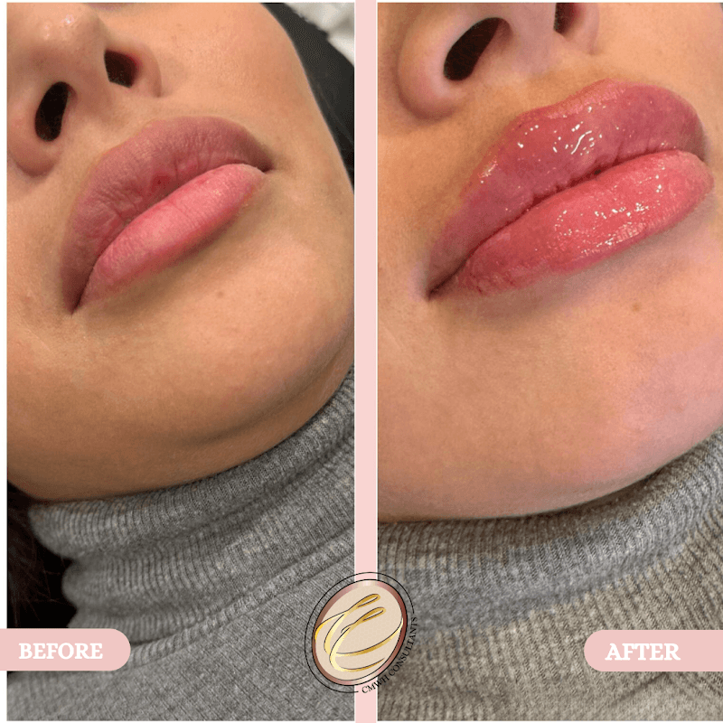 Creole Contour Aesthetics Tomball photo