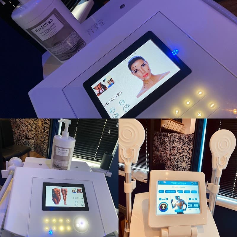 Cryo Solihull photo