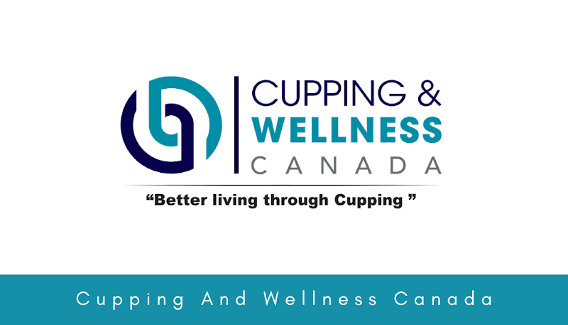 Cupping and Wellness Canada Kitchener photo
