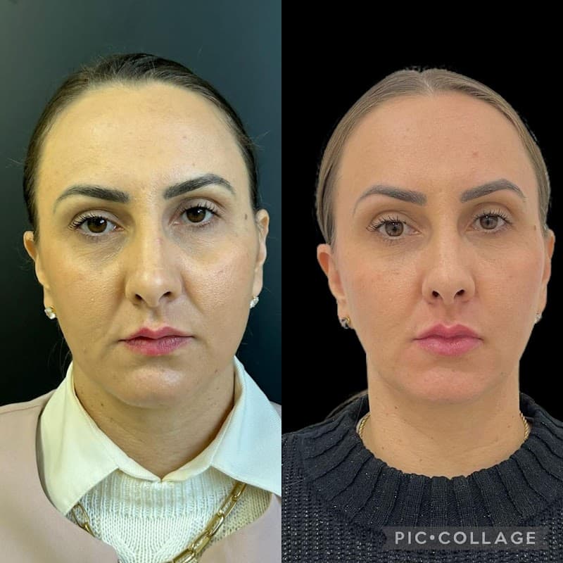 Danielle Herbst Estética Salete photo